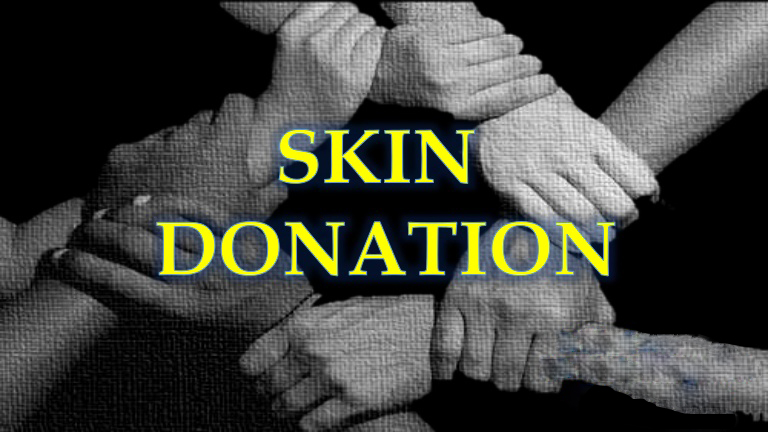 Skin Donation